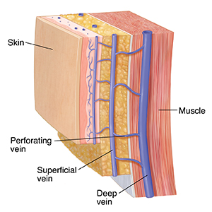 Section of skin and muscle showing deep, superficial, and perforating veins.