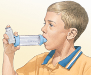 Boy using metered-dose inhaler with spacer.