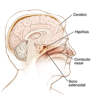 Vista lateral de una cabeza de una mujer en la que se muestran el cerebro, la hipófisis, el seno esfenoidal y el conducto nasal.