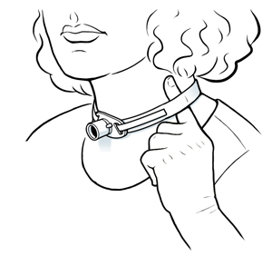 Primer plano de un cuello en el que se ve un tubo de traqueostomía y un dedo debajo de la cinta que sostiene el tubo. 